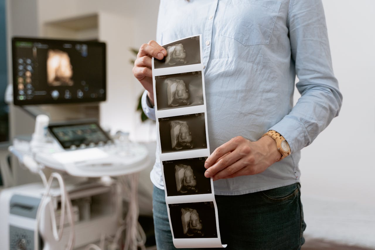 A person holding ultrasound images in a medical clinic, showcasing pregnancy monitoring.